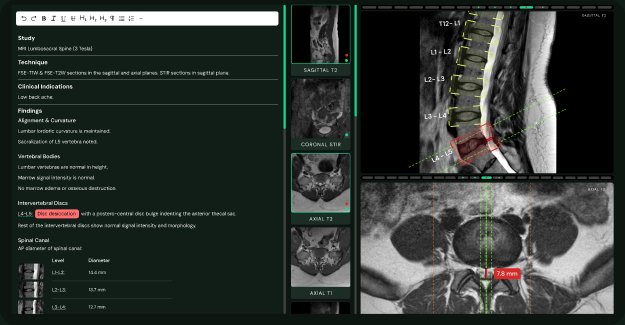 MedSee interactive radiology report with linked images, measurements, and physician Q&A