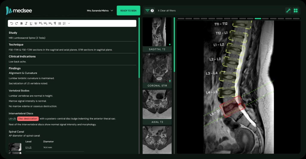 MedSee interactive report with linked images, AI measurements and physician Q&A